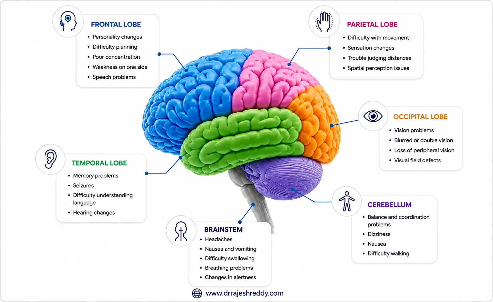Brain Tumor Symptoms by Location Diagram